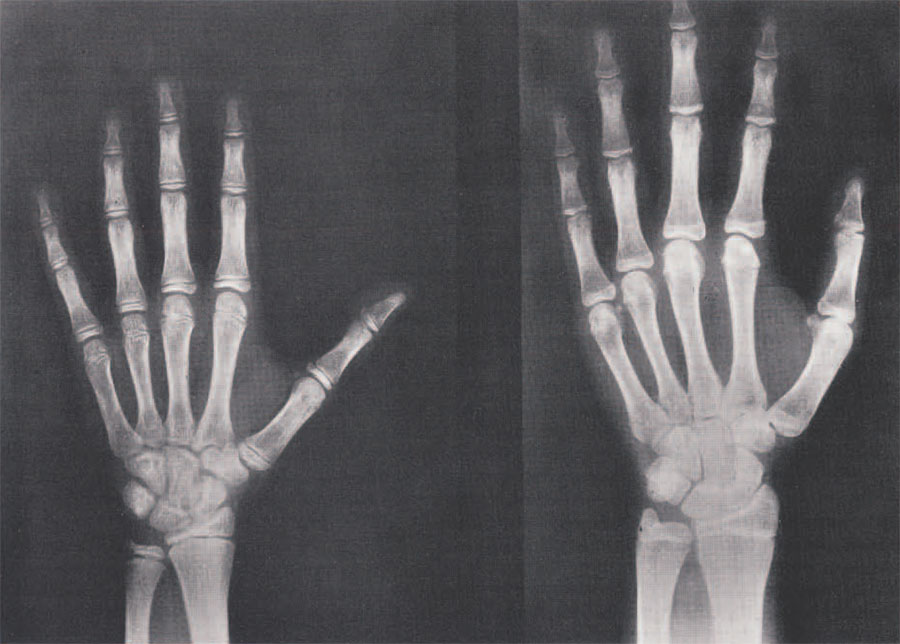 human_development_growth_xrays