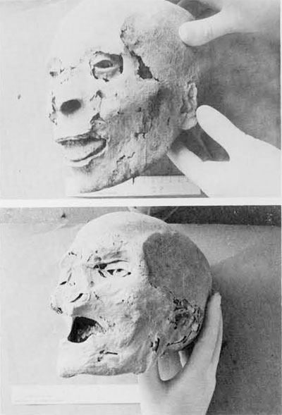 These two extraordinarily well-preserved heads from the Dira Abu el-Naga site are being examined for evidence of eye and ear disease.