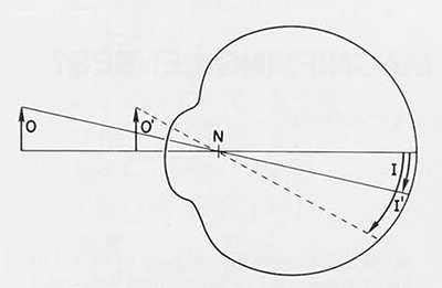 The diagram illustrates how and why magnification occurs as the object is brought closer to the lens Magnification=diopter/4. According to the laws of optics, there is no difference in the essentials nature of magnification, whether it is due to a lens, a myopic eye, or the accommodating power of a young normal eye. All three capable of producing the angular magnification shown here.