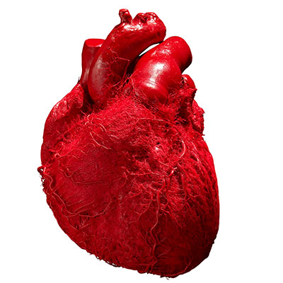 A human heart with veins and arteries exposed.
