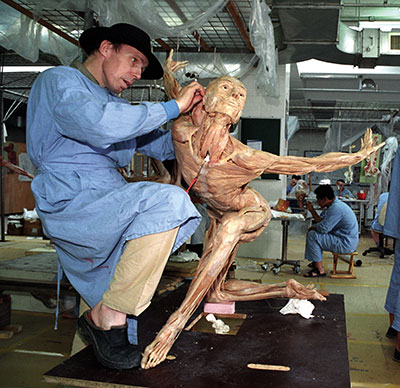 A man in a blue medical gown pins and poses a musculature of a women doing a ballet pose.