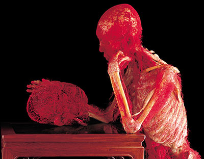 A sculpture of a seated person, head resting on one hand, blood vessels covering their body.