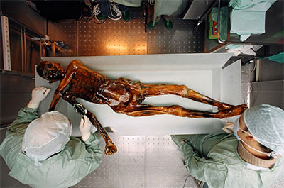 Ötzi's remains on a table in a lab with two scientists studying him.
