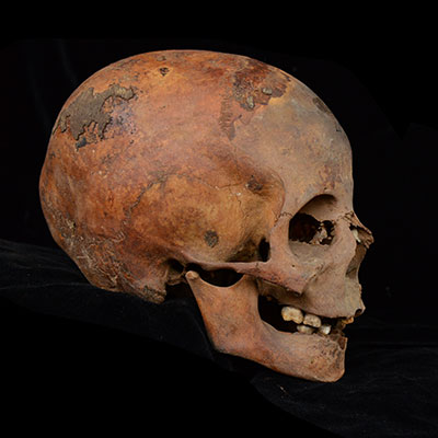 Profile view of a human skull.
