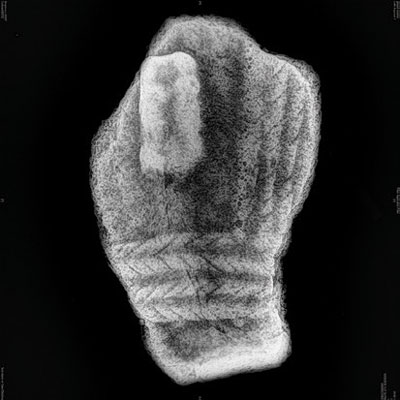 An x-ray of the coffin fragment