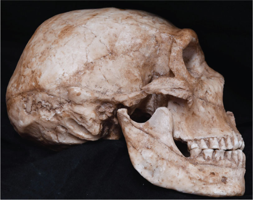 Side view of the skull.
